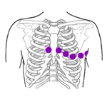 Ubicación de los Electrodos del Electrocardiograma