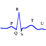 Ondas del Electrocardiograma