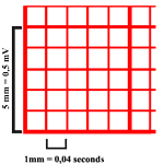 Papel del Electrocardiograma