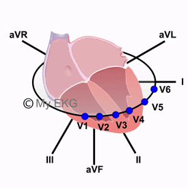 Localización de las Derivaciones Cardiacas