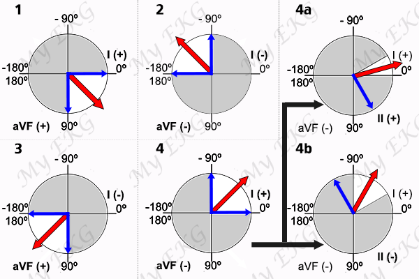 Determinación Rápida del Eje Cardiaco