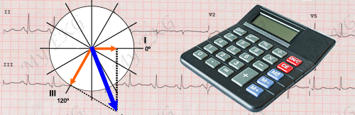 Cálculo Exacto del Eje Cardiaco