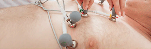 Ubicación de los Electrodos del Electrocardiograma