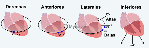 Correlación entre  Derivaciones y Paredes Cardiacas