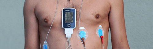 ¿Qué es el Holter EKG?