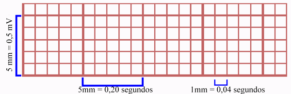 Características del Papel del EKG