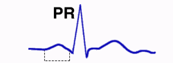 Intervalo PR