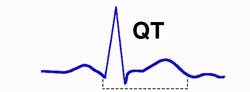 Intervalo QT