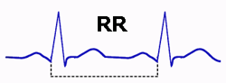 Intervalo RR