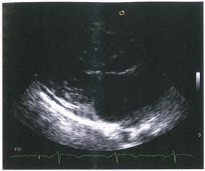 Tercera Imagen de Cardiología del Examen MIR 2016