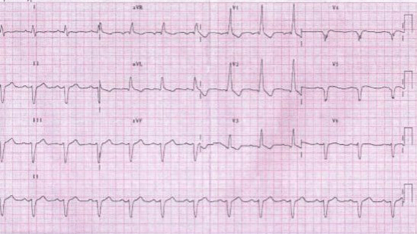 Primera Imagen de Cardiología del Examen MIR 2018