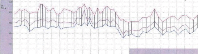 Segunda Imagen de Cardiología del Examen MIR 2018