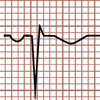 Morfología del QRS Qr