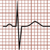 Complejo QRS isobifásico o isodifásico