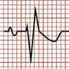 Morfología del QRS rSr', Bloqueo de Rama Derecha