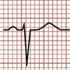 Complejo QRS Negativo