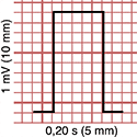 Test de voltaje del Electrocardiograma